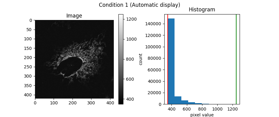 Condition 1 (Automatic display), Image, Histogram