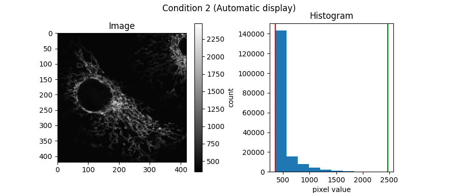 Condition 2 (Automatic display), Image, Histogram